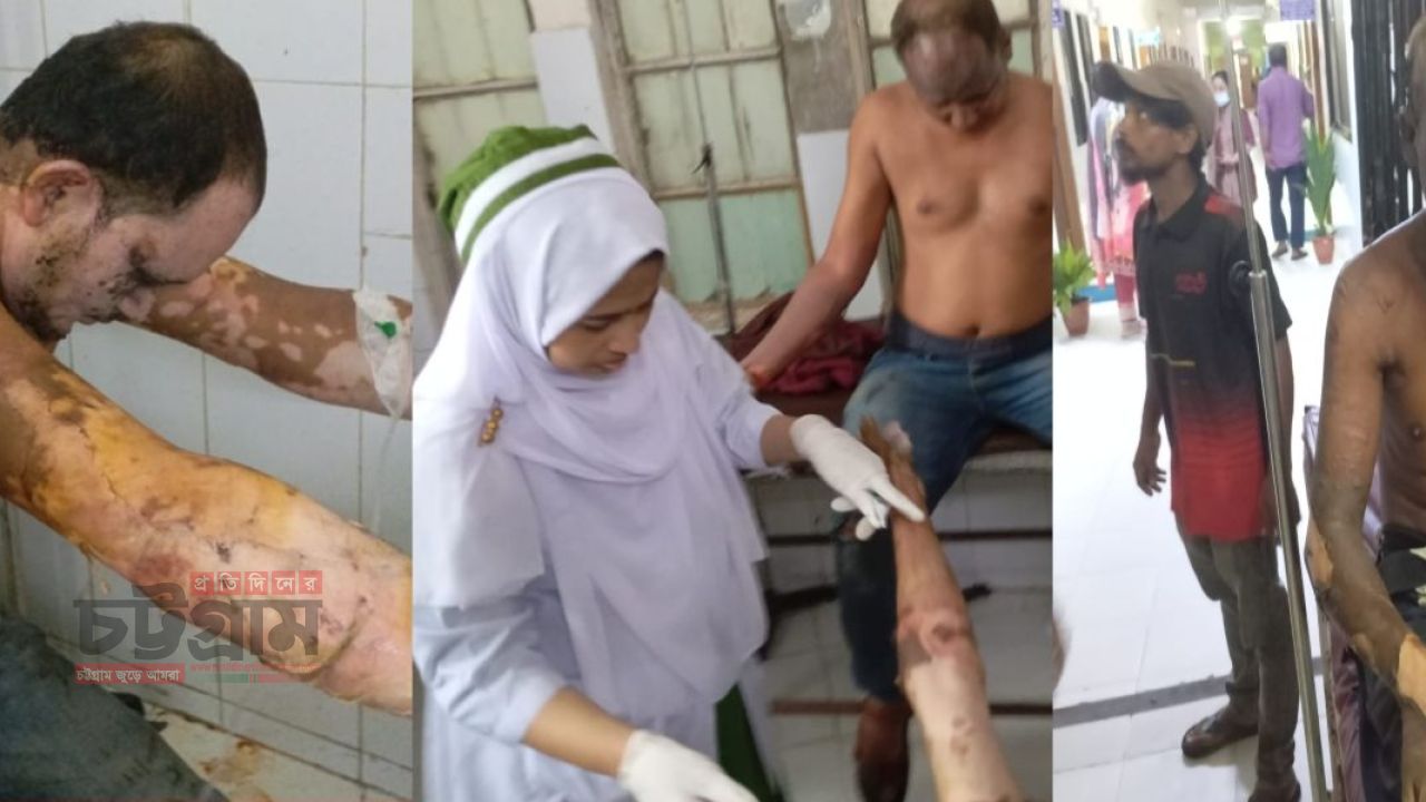 চট্টগ্রাম বোয়ালখালী কনফিডেন্স লবণ কারখানায় আগুনে দগ্ধ ১০ শ্রমিক
