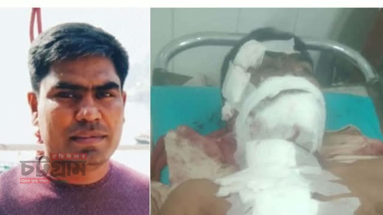 রাইখালীতে সড়ক দুর্ঘটনাঃ গুরুতর আহত বাঙ্গালহালিয়া বাজারের ব্যবসায়ী সুজন চৌধুরী।